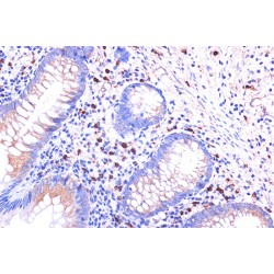 Complement Component 5a Receptor 1 (C5AR1) Antibody