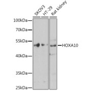 Western blot analysis of extracts of various cell lines using HOXA10 Antibody (1/1000 dilution).