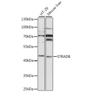 Western blot analysis of extracts of various cell lines using STRADB Antibody (1/1000 dilution).