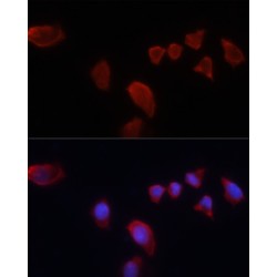 Carbonic Anhydrase 9 (CA9) Antibody