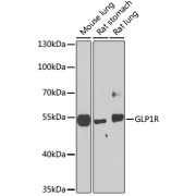 Western blot analysis of extracts of various cell lines using GLP1R Antibody (1/1000 dilution).