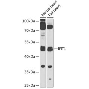 Western blot analysis of extracts of various cell lines using IFIT1 Antibody (1/1000 dilution).