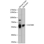 Western blot analysis of extracts of various cell lines using CACNB4 Antibody (1/1000 dilution).