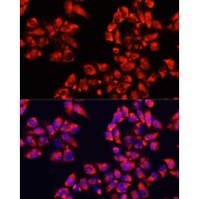 Immunofluorescence analysis of HeLa cells using ALDH7A1 Antibody (1/100 dilution). Blue: DAPI for nuclear staining.