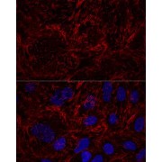 Confocal immunofluorescence analysis of U2OS cells using SEPT9 Antibody (1/100 dilution). Blue: DAPI for nuclear staining.