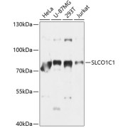 Western blot analysis of extracts of various cell lines using SLCO1C1 Antibody (1/1000 dilution).