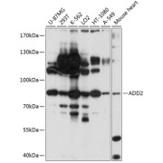 Western blot analysis of extracts of various cell lines using ADD2 Antibody (1/1000 dilution).