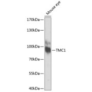 Western blot analysis of extracts of Mouse eye using TMC1 Antibody (1/1000 dilution).