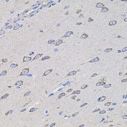 Transmembrane Channel-Like Protein 1 (TMC1) Antibody