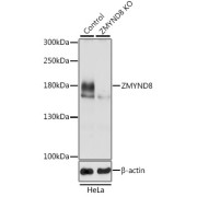 Western blot analysis of extracts from normal (control) and ZMYND8 knockout (KO) HeLa cells, using ZMYND8 Antibody (1/3000 dilution).