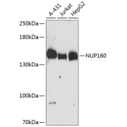 Western blot analysis of extracts of various cell lines using NUP160 Antibody (1/3000 dilution).