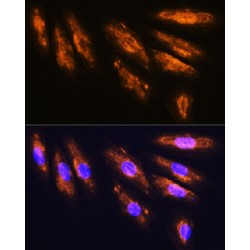 Glutamate Receptor Ionotropic, NMDA 2A (GRIN2A) Antibody