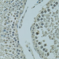 PR/SET Domain 2 (PRDM2) Antibody