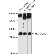 Western blot analysis of extracts of various cell lines using HLA-DQA2 Antibody (1/3000 dilution).