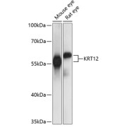 Western blot analysis of extracts of various cell lines using KRT12 Antibody (1/1000 dilution).