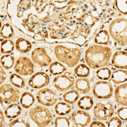 Protein O-GlcNAcase / MGEA5 (OGA) Antibody