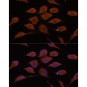 Immunofluorescence analysis of L929 cells using USP19 Antibody (1/100 dilution). Blue: DAPI for nuclear staining.