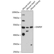 Western blot analysis of extracts of various cell lines using DNPEP Antibody (1/3000 dilution).