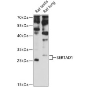 Western blot analysis of extracts of various cell lines using SERTAD1 Antibody (1/3000 dilution).