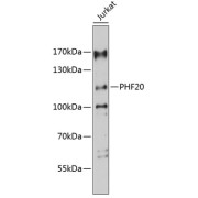 Western blot analysis of extracts of Jurkat cells using PHF20 Antibody (1/3000 dilution).