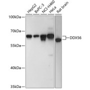 Western blot analysis of extracts of various cell lines using DDX56 Antibody (1/3000 dilution).