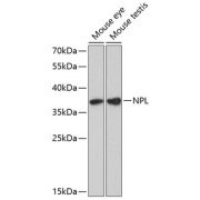 Western blot analysis of extracts of various cell lines using NPL Antibody (1/3000 dilution).