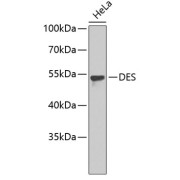 Western blot analysis of extracts of HeLa cells using DES Antibody.