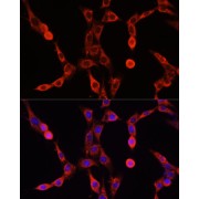 Immunofluorescence analysis of NIH/3T3 cells using ABCD1 Antibody (1/100 dilution). Blue: DAPI for nuclear staining.