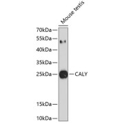 Western blot analysis of extracts of mouse testis using CALY Antibody (1/1000 dilution).