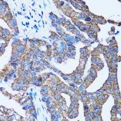 Caspase 3 (CASP3) Antibody