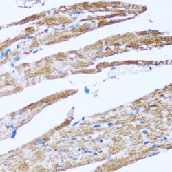 Caspase 3 (CASP3) Antibody