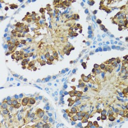 Caspase 3 (CASP3) Antibody