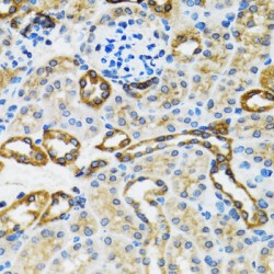 Caspase 3 (CASP3) Antibody