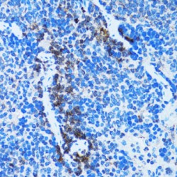 Caspase 3 (CASP3) Antibody