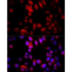 Caspase 3 (CASP3) Antibody