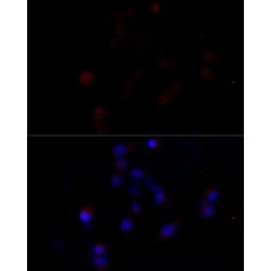 Caspase 3 (CASP3) Antibody