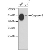 Western blot analysis of extracts of various cell lines using Caspase-8 Antibody (1/1000 dilution).