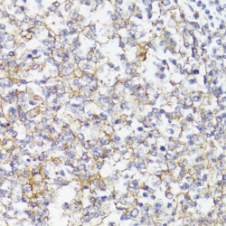 Cluster of Differentiation 276 (CD276) Antibody