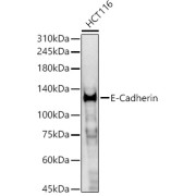 Western blot analysis of HCT116 using E-Cadherin Antibody (1/400 dilution).