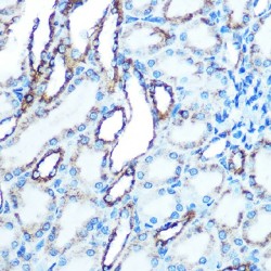 Cadherin-1 / E-Cadherin (CDH1) Antibody