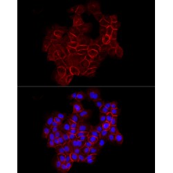 Cadherin-1 / E-Cadherin (CDH1) Antibody