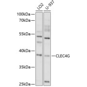 Western blot analysis of extracts of various cell lines using CLEC4G Antibody (1/1000 dilution).