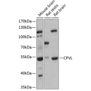 Western blot analysis of extracts of various cell lines using CPVL Antibody (1/3000 dilution).