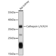 Western blot analysis of extracts of Rat kidney using Cathepsin L/V/K/H Antibody (1/3000 dilution).