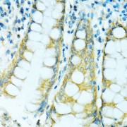 Immunohistochemistry of paraffin-embedded Human colon using CYP2B6 Antibody (1/100 dilution, 40x lens).