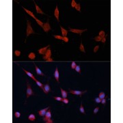 Immunofluorescence analysis of NIH-3T3 cells using DDAH1 Antibody (1/100 dilution, 40x lens). Blue: DAPI for nuclear staining.