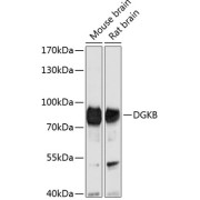 Western blot analysis of extracts of various cell lines using DGKB Antibody (1/1000 dilution).