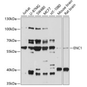 Western blot analysis of extracts of various cell lines using ENC1 Antibody (1/1000 dilution).