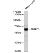 Western blot analysis of extracts of Mouse lung using ENTPD3 Antibody (1/1000 dilution).