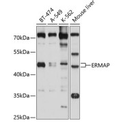 Western blot analysis of extracts of various cell lines using ERMAP Antibody (1/1000 dilution).